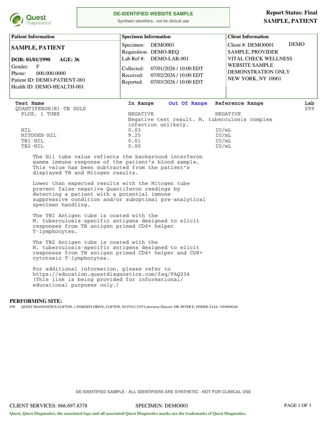 Synthetic Quest QuantiFERON laboratory result included behind the HCO tuberculosis certificate